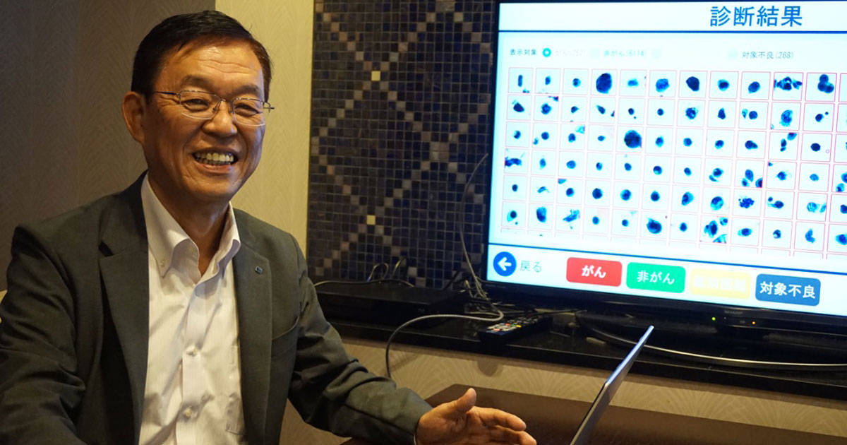 人がAIをサポート。逆転の発想から誕生したBakeryScan